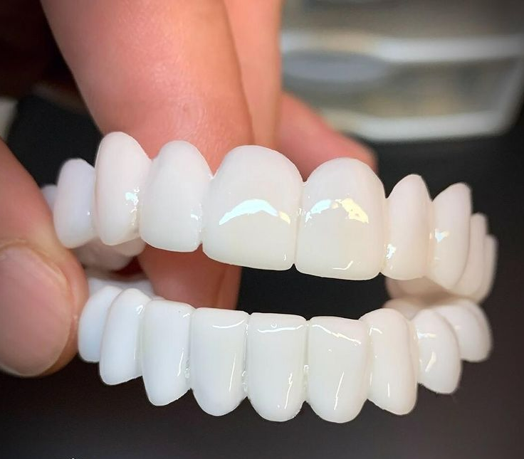 Dental Prosthesis – Flexible Natural-Looking Fit & Pain-Free Comfort
