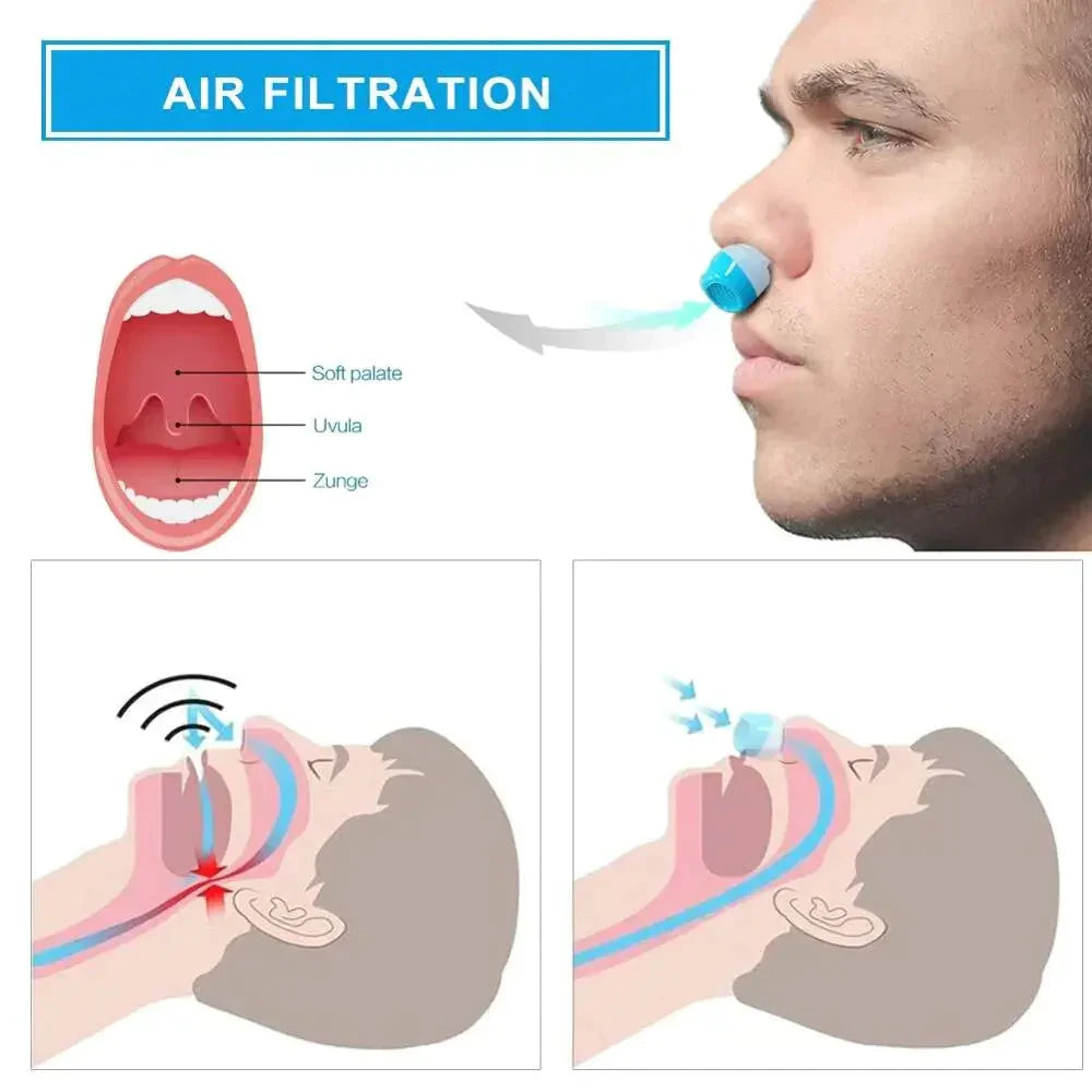 Portable Micro CPAP Sleep Apnea Machine - Travel-Friendly Anti-Snoring Solution & CPAP Alternative
